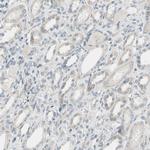 alpha Internexin Antibody in Immunohistochemistry (Paraffin) (IHC (P))