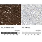 alpha Internexin Antibody