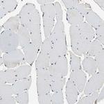 GM2A Antibody in Immunohistochemistry (Paraffin) (IHC (P))