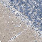 CACNA2D1 Antibody in Immunohistochemistry (Paraffin) (IHC (P))