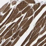 CACNA2D1 Antibody in Immunohistochemistry (Paraffin) (IHC (P))