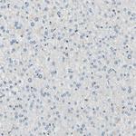 OXSR1 Antibody in Immunohistochemistry (Paraffin) (IHC (P))