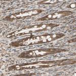 OXSR1 Antibody in Immunohistochemistry (Paraffin) (IHC (P))