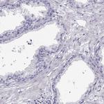 alpha Actinin 2 Antibody in Immunohistochemistry (Paraffin) (IHC (P))