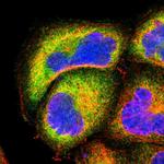 NFkB p100 Antibody in Immunocytochemistry (ICC/IF)