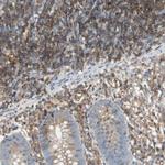 NFkB p100 Antibody in Immunohistochemistry (Paraffin) (IHC (P))