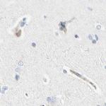 NFkB p100 Antibody in Immunohistochemistry (Paraffin) (IHC (P))