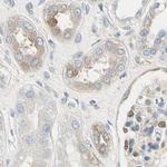 NFkB p100 Antibody in Immunohistochemistry (Paraffin) (IHC (P))