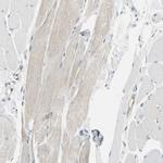 NFkB p100 Antibody in Immunohistochemistry (Paraffin) (IHC (P))