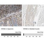 NFkB p100 Antibody