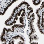 Progesterone Receptor Antibody in Immunohistochemistry (Paraffin) (IHC (P))