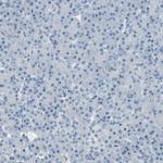 Progesterone Receptor Antibody in Immunohistochemistry (Paraffin) (IHC (P))