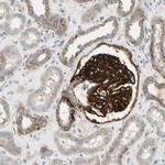 ITGA3 Antibody in Immunohistochemistry (Paraffin) (IHC (P))