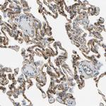 ITGA3 Antibody in Immunohistochemistry (Paraffin) (IHC (P))