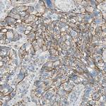 ITGA3 Antibody in Immunohistochemistry (Paraffin) (IHC (P))