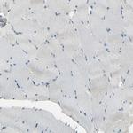 ITGA3 Antibody in Immunohistochemistry (Paraffin) (IHC (P))