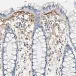 TGFBI Antibody in Immunohistochemistry (Paraffin) (IHC (P))