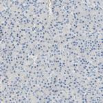 TGFBI Antibody in Immunohistochemistry (Paraffin) (IHC (P))