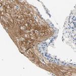 TGFBI Antibody in Immunohistochemistry (Paraffin) (IHC (P))