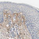 TGFBI Antibody in Immunohistochemistry (Paraffin) (IHC (P))