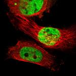 SUFU Antibody in Immunocytochemistry (ICC/IF)