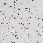 SUFU Antibody in Immunohistochemistry (Paraffin) (IHC (P))