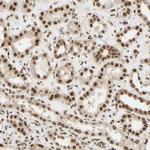 SUFU Antibody in Immunohistochemistry (Paraffin) (IHC (P))