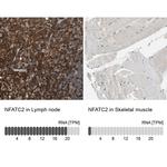 NFATC2 Antibody