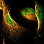 NFATC2 Antibody in Immunocytochemistry (ICC/IF)