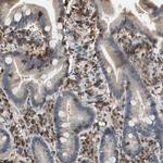 NFATC2 Antibody in Immunohistochemistry (Paraffin) (IHC (P))