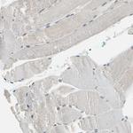 NFATC2 Antibody in Immunohistochemistry (Paraffin) (IHC (P))