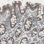 Ephrin B2 Antibody in Immunohistochemistry (Paraffin) (IHC (P))