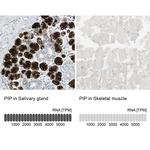 GCDFP-15 Antibody