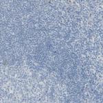 GCDFP-15 Antibody in Immunohistochemistry (Paraffin) (IHC (P))