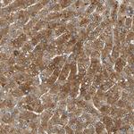 LDLR Antibody in Immunohistochemistry (Paraffin) (IHC (P))