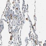 LDLR Antibody in Immunohistochemistry (Paraffin) (IHC (P))