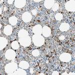 CD63 Antibody in Immunohistochemistry (Paraffin) (IHC (P))