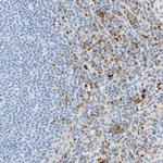 CD63 Antibody in Immunohistochemistry (Paraffin) (IHC (P))