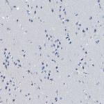 ACMSD Antibody in Immunohistochemistry (Paraffin) (IHC (P))