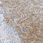 ACMSD Antibody in Immunohistochemistry (Paraffin) (IHC (P))