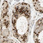 KIF11 Antibody in Immunohistochemistry (Paraffin) (IHC (P))