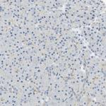 KIF11 Antibody in Immunohistochemistry (Paraffin) (IHC (P))