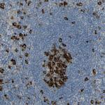 KIF11 Antibody in Immunohistochemistry (Paraffin) (IHC (P))