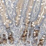 KIF11 Antibody in Immunohistochemistry (Paraffin) (IHC (P))