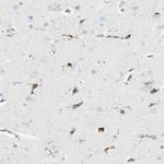 CD74 Antibody in Immunohistochemistry (Paraffin) (IHC (P))