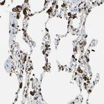 CD74 Antibody in Immunohistochemistry (Paraffin) (IHC (P))