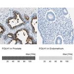 PSMA Antibody