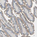 PSMA Antibody in Immunohistochemistry (Paraffin) (IHC (P))