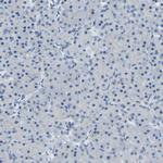 PSMA Antibody in Immunohistochemistry (Paraffin) (IHC (P))