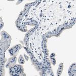 PSMA Antibody in Immunohistochemistry (Paraffin) (IHC (P))